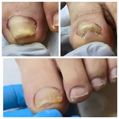 PODOLOG KONIN - GABINET PODOLOGICZNY PREVENTI MAGDALENA PISKORZ